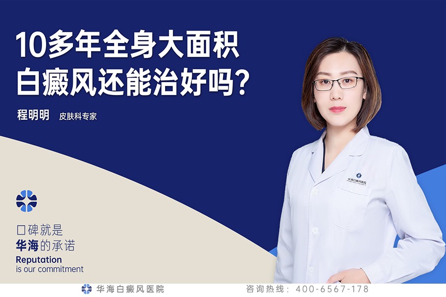 10多年全身大面积白癜风还能治好吗？