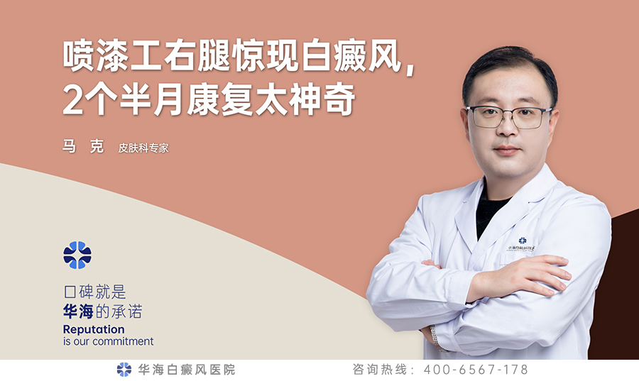 喷漆工右腿惊现白癜风，2个半月康复太神奇