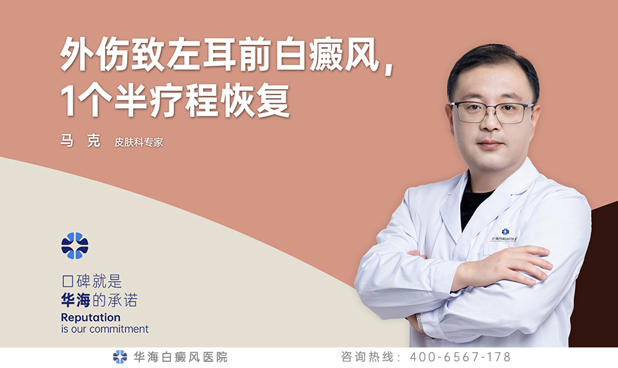 外伤致左耳前白癜风，1个半疗程恢复