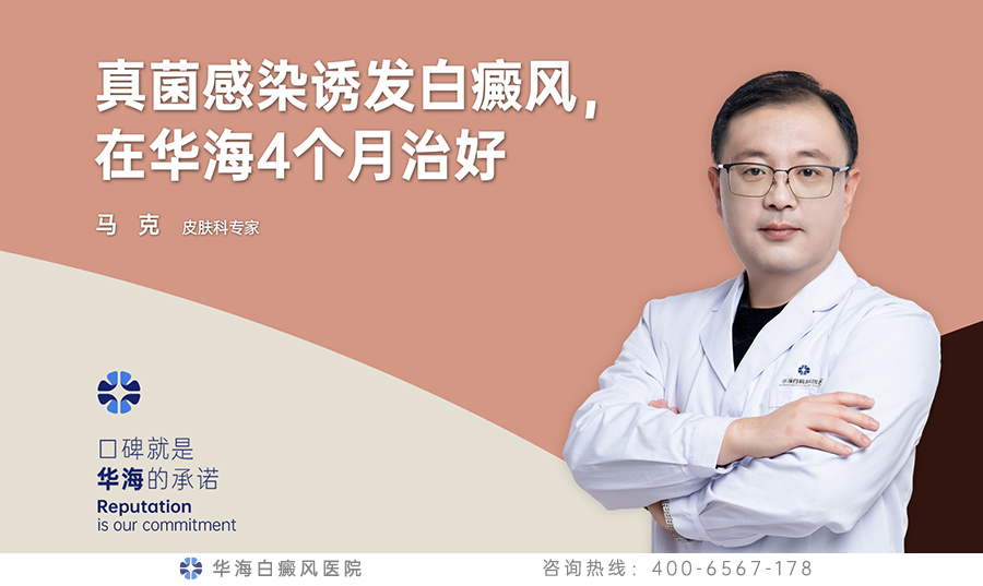 真菌感染诱发白癜风，在华海4个月治好