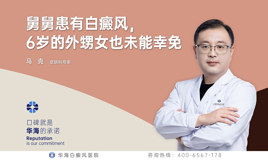 白癜风遗传吗.jpg