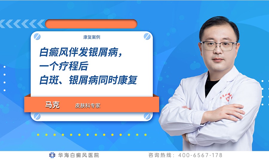 白癜风伴发银屑病，一个疗程后白斑、银屑病同时康复