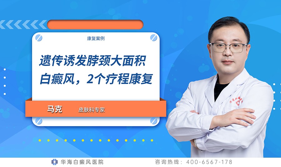 遗传诱发脖颈大面积白癜风，2个疗程康复